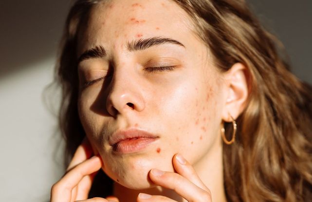 Automne : L’ennemi caché de votre peau !