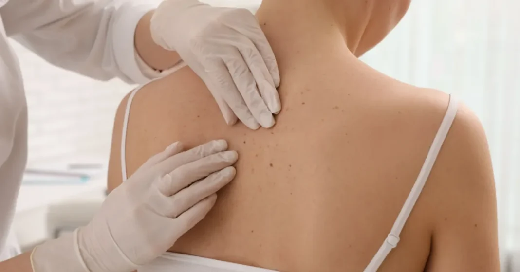 Pénurie de dermatologues : solutions innovantes